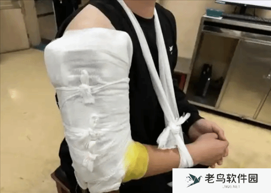俩小伙挑战与机器人“掰手腕” 结果当场双双骨折
